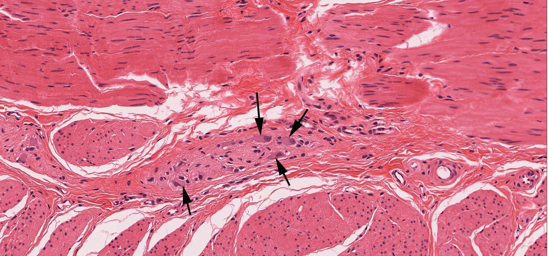 Peripheral Nervous System | histology