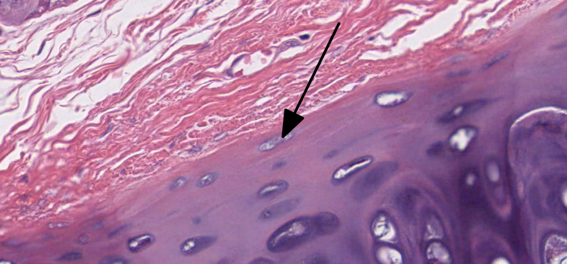 Cartilage and Mature Bone | histology