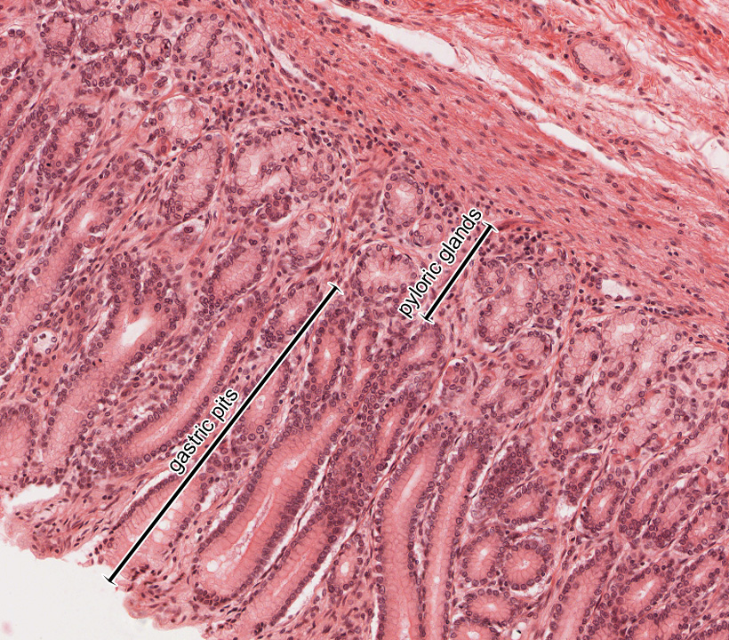Pharynx, Esophagus, and Stomach | histology